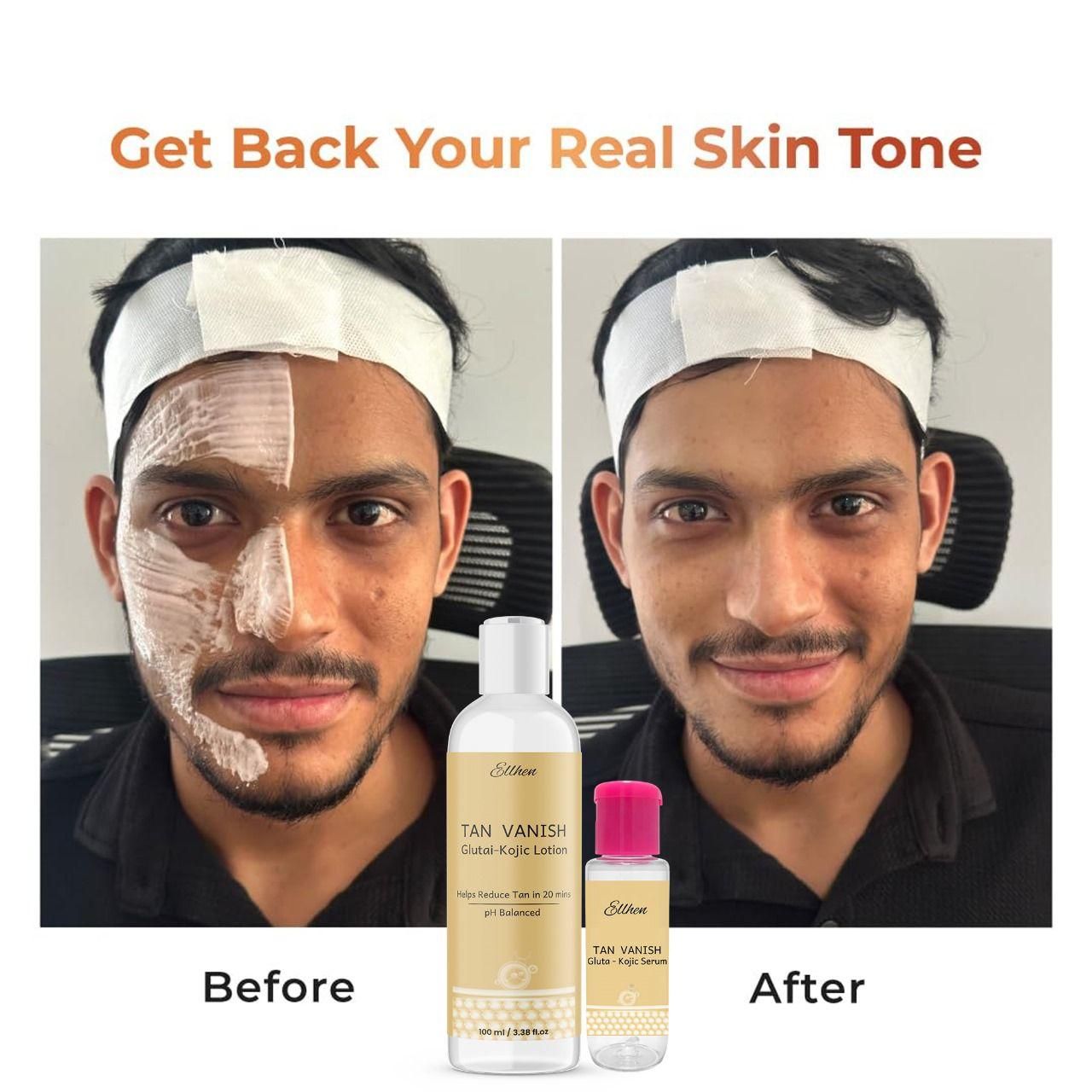 Tan Vanish Glutai Kojic Lotion and Gluta Kojic Serum 100 ml